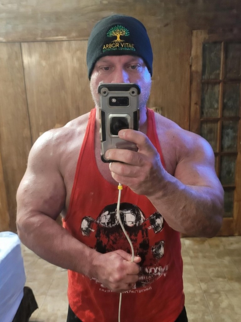 Rich Selfie prior to surgery